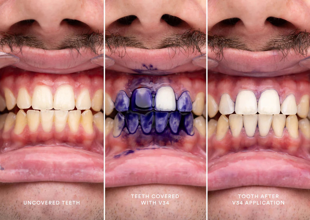 Dentrificio Correttore di Colore
